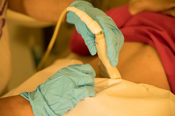 A close-up of a staff member performing an ultrasound on a model posing as a patient.